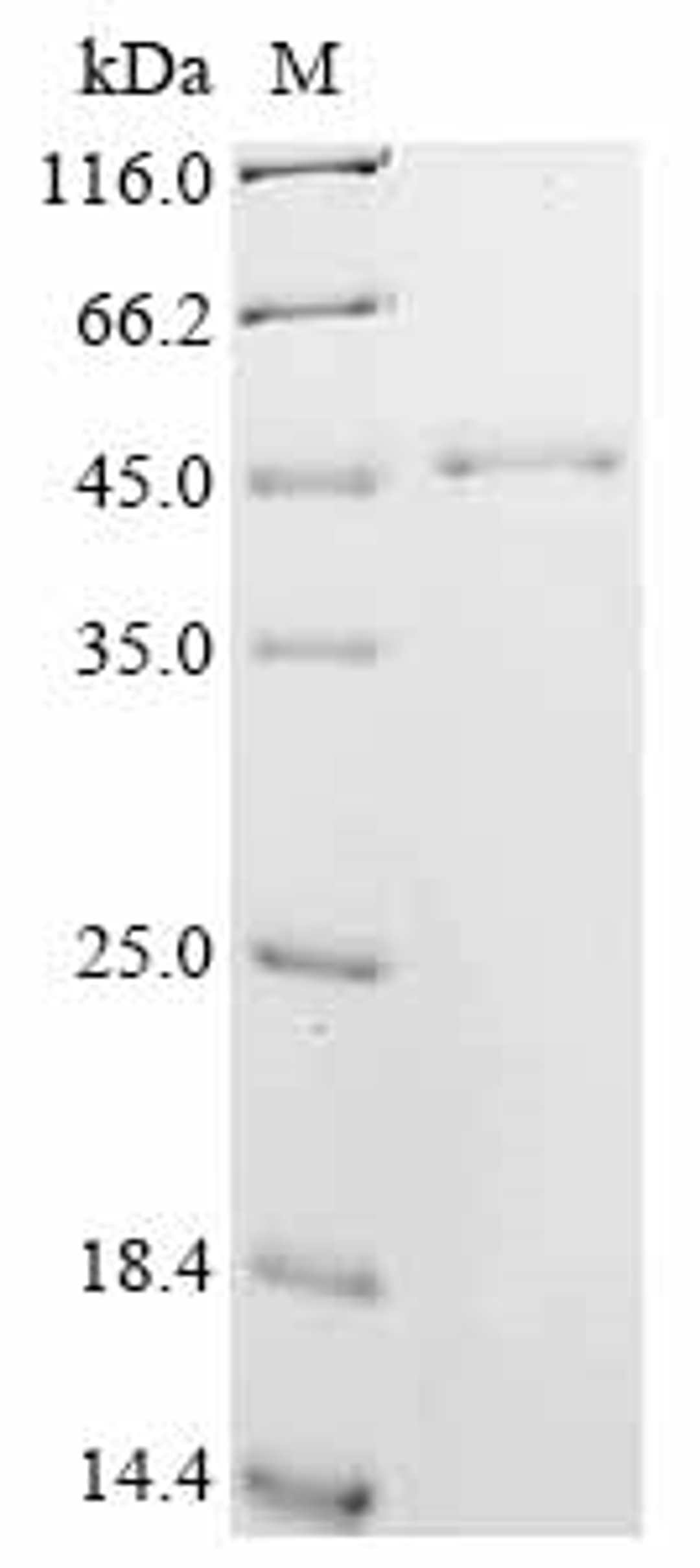 (Tris-Glycine gel) Discontinuous SDS-PAGE (reduced) with 5% enrichment gel and 15% separation gel.