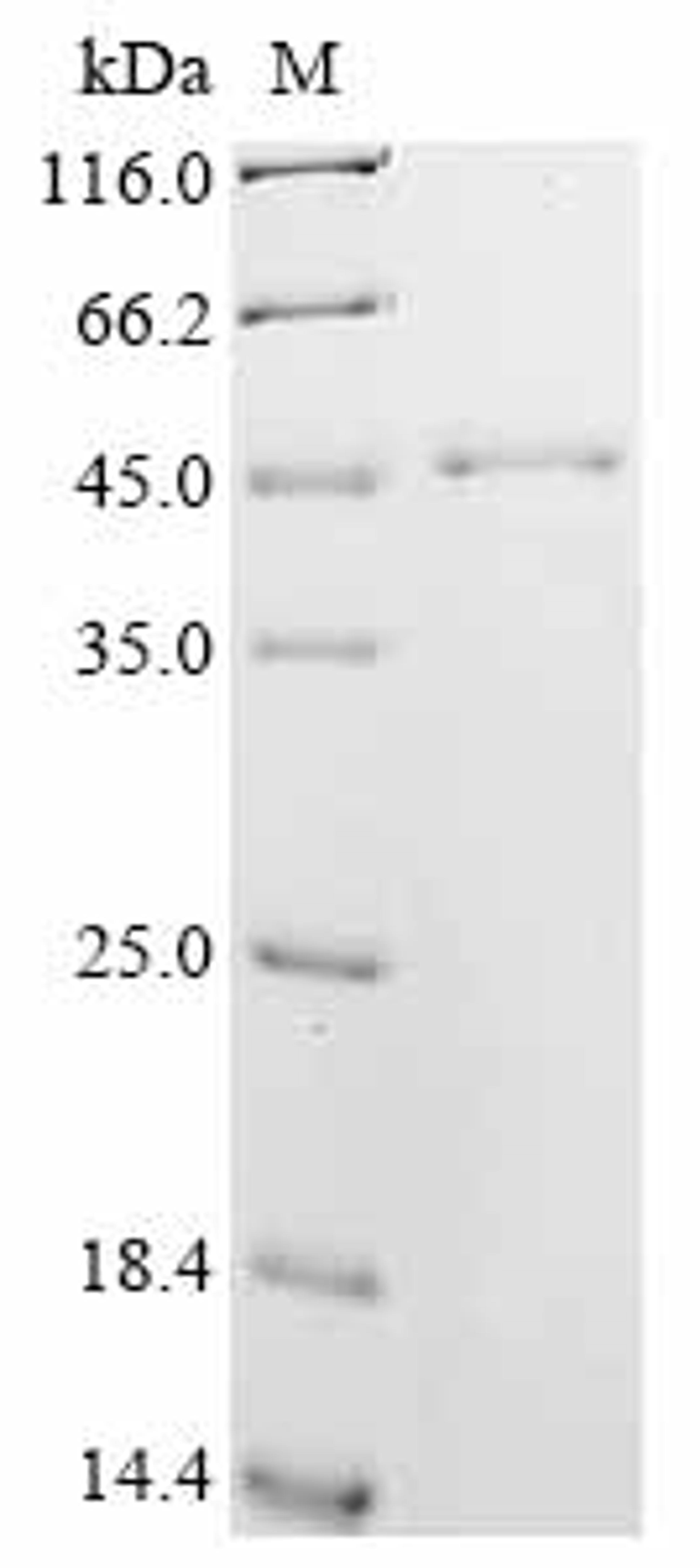 (Tris-Glycine gel) Discontinuous SDS-PAGE (reduced) with 5% enrichment gel and 15% separation gel.