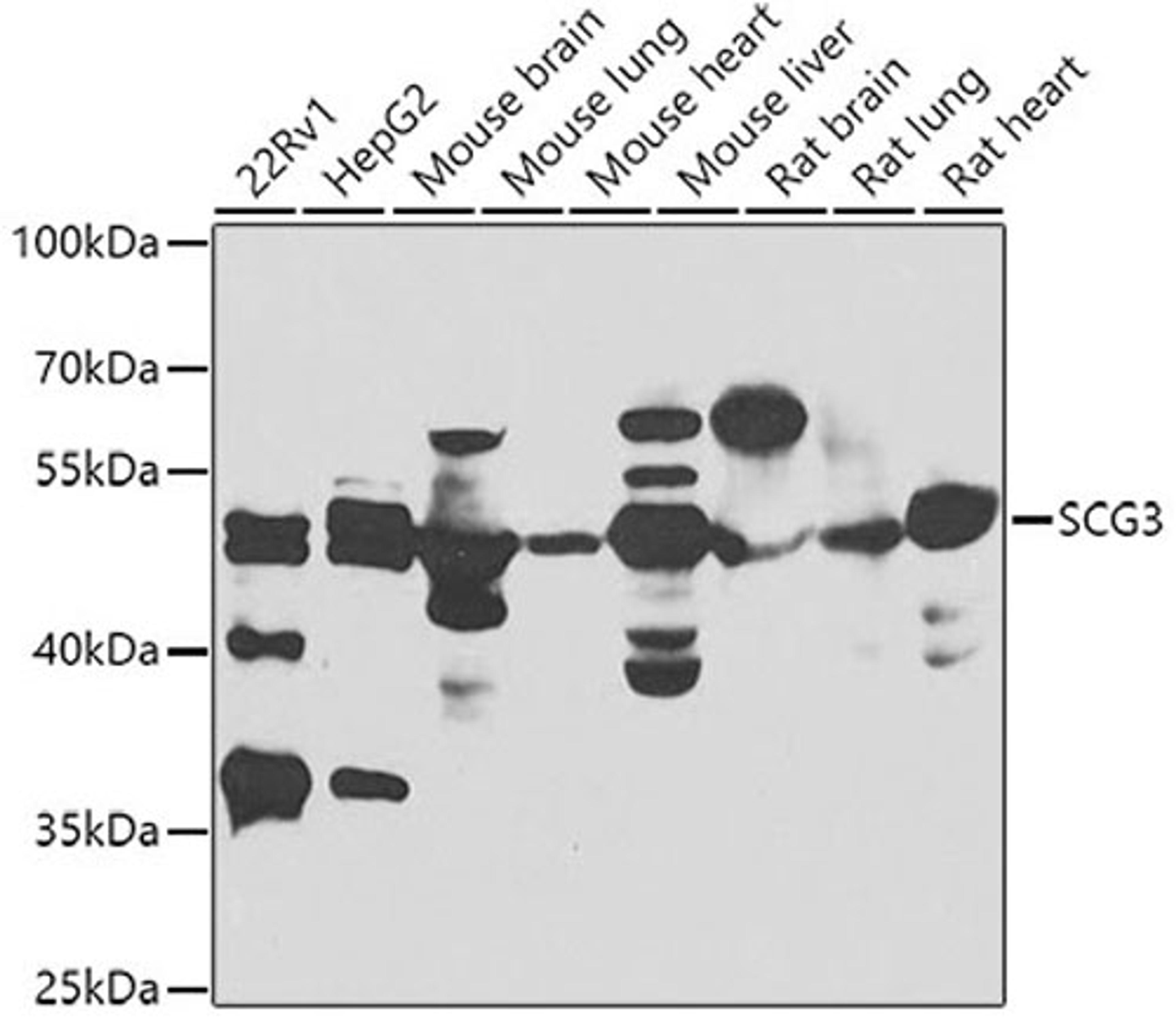 Western blot - SCG3 antibody (A7799)