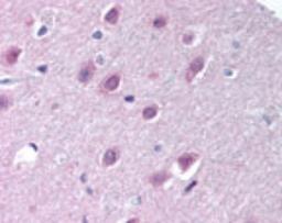 Immunohistochemistry-Paraffin: Importin-9 Antibody [NB100-56489] - analysis of human brain, cortex using this antibody at 10 ug/ml.