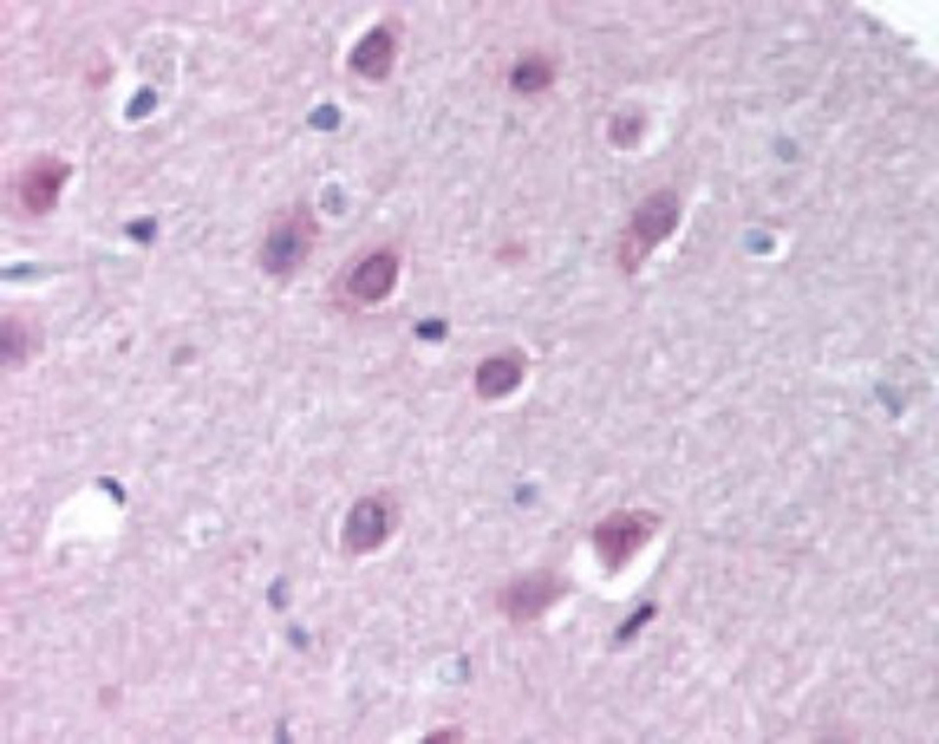 Immunohistochemistry-Paraffin: Importin-9 Antibody [NB100-56489] - analysis of human brain, cortex using this antibody at 10 ug/ml.