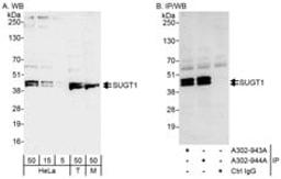 Detection of human and mouse Sgt1 (SUGT) by western blot (h&m) and immunoprecipitation (h).