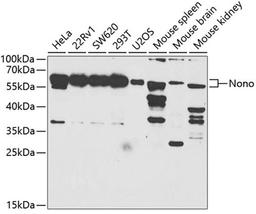 Western blot - Nono antibody (A5282)