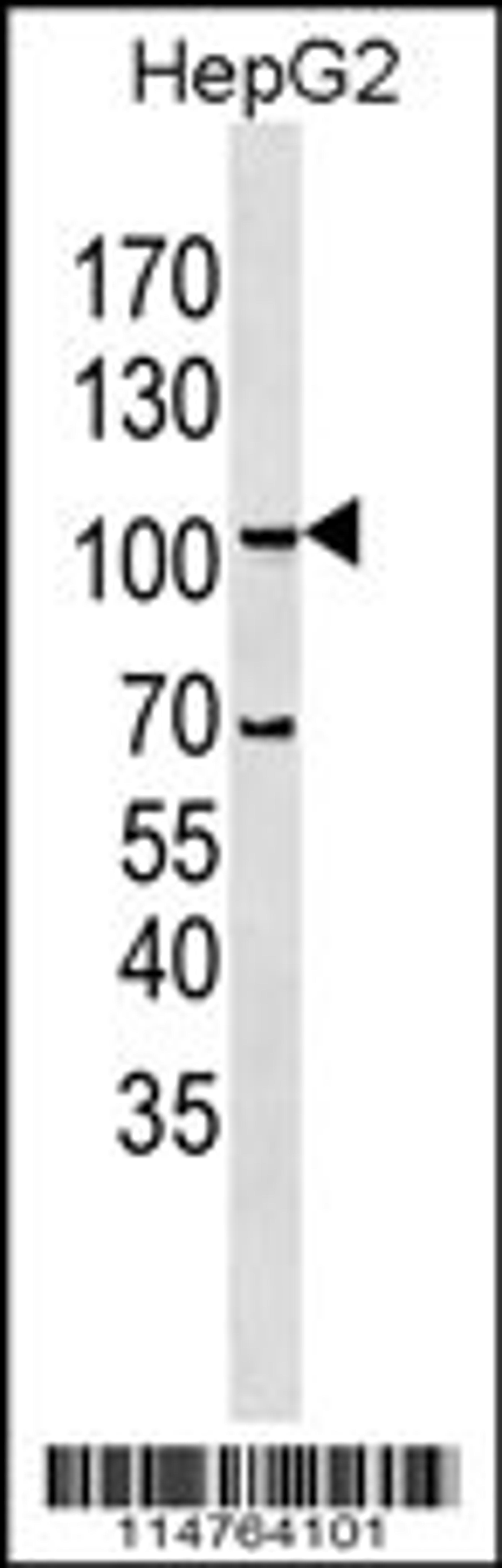 Western blot analysis in HepG2 cell line lysates (35ug/lane).This demonstrates the LGR5/GPR49 antibody detected the LGR5/GPR49 protein (arrow)(Kindly offered by Dr. Li).