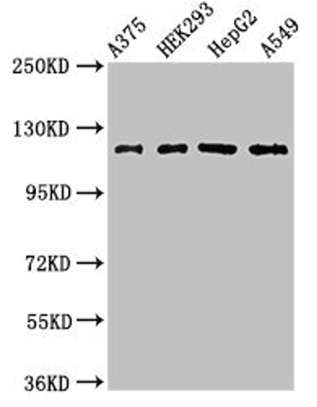 Western Blot. Positive WB detected in: A375 whole cell lysate, HEK293 whole cell lysate, HepG2 whole cell lysate, A549 whole cell lysate. All lanes: FARP1 antibody at 3ug/ml. Secondary. Goat polyclonal to rabbit IgG at 1/50000 dilution. Predicted band size: 119, 123, 15 kDa. Observed band size: 119 kDa. 
