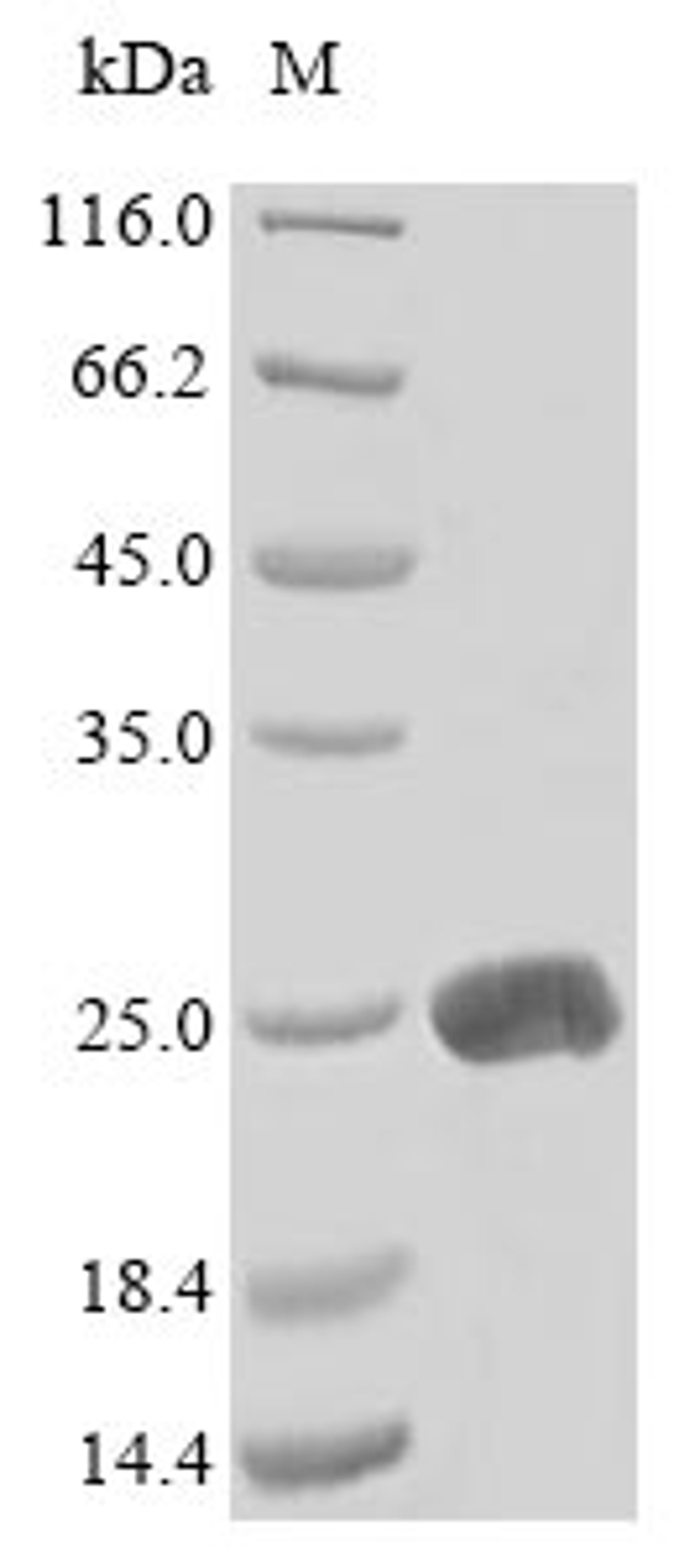 (Tris-Glycine gel) Discontinuous SDS-PAGE (reduced) with 5% enrichment gel and 15% separation gel.