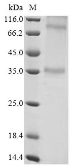 (Tris-Glycine gel) Discontinuous SDS-PAGE (reduced) with 5% enrichment gel and 15% separation gel.