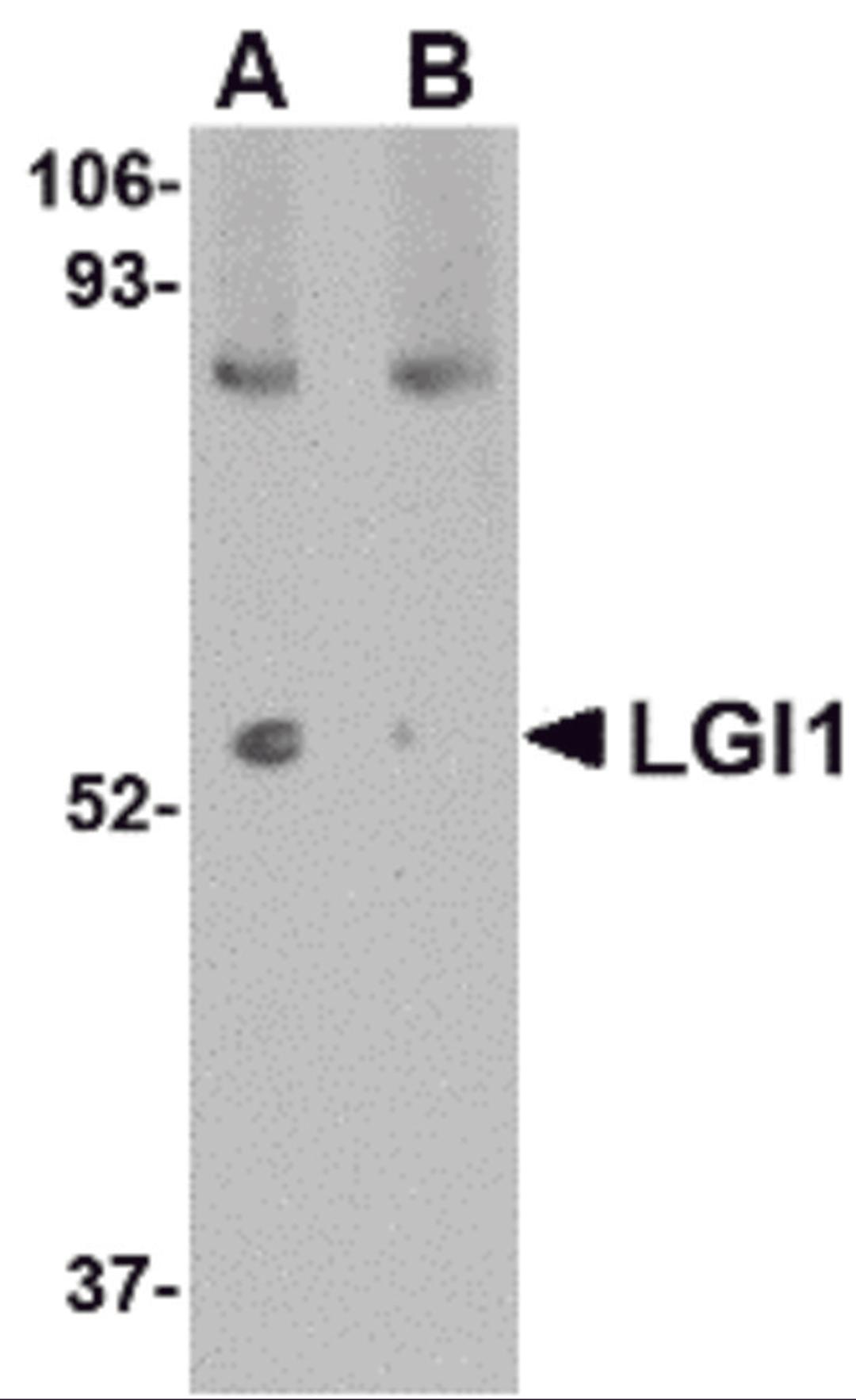 Western blot analysis of LGI1 in mouse brain tissue lysate with LGI1 antibody at 1 μg/mL in (A) the absence and (B) the presence of blocking peptide.