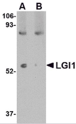 Western blot analysis of LGI1 in mouse brain tissue lysate with LGI1 antibody at 1 μg/mL in (A) the absence and (B) the presence of blocking peptide.