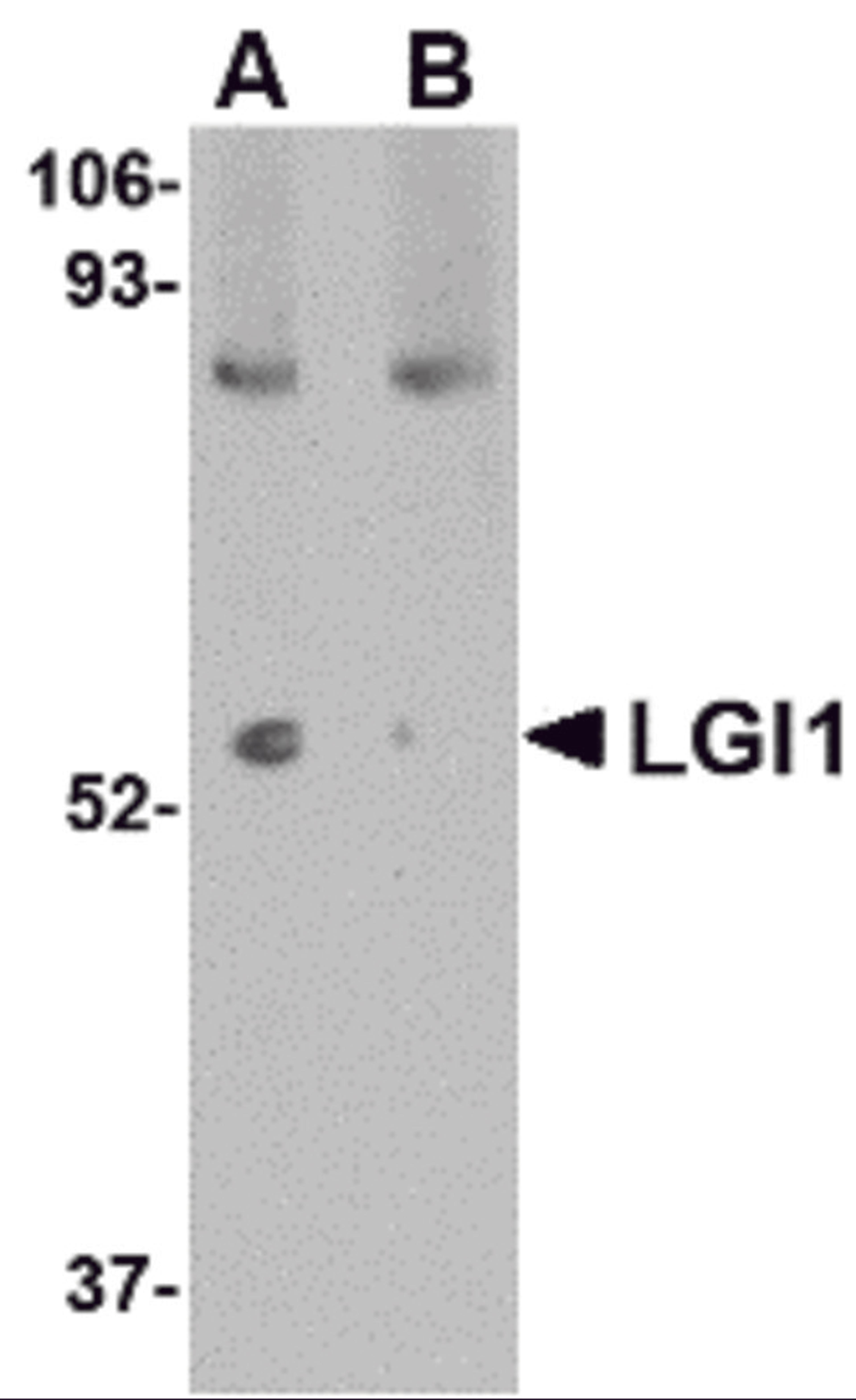 Western blot analysis of LGI1 in mouse brain tissue lysate with LGI1 antibody at 1 μg/mL in (A) the absence and (B) the presence of blocking peptide.