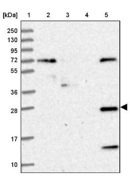 Western Blot: Heparan sulfate 2-O-sulfotransferase 1 Antibody [NBP1-91982] - Lane 1: Marker [kDa] 250, 130, 95, 72, 55, 36, 28, 17, 10<br/>Lane 2: Human cell line RT-4<br/>Lane 3: Human cell line U-251MG sp<br/>Lane 4: Human plasma (IgG/HSA depleted)<br/>Lane 5: Human liver tissue