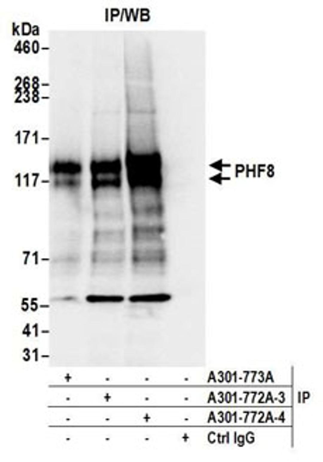 Detection of human PHF8 by western blot of immunoprecipitates.