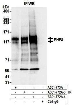 Detection of human PHF8 by western blot of immunoprecipitates.