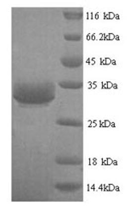 (Tris-Glycine gel) Discontinuous SDS-PAGE (reduced) with 5% enrichment gel and 15% separation gel.