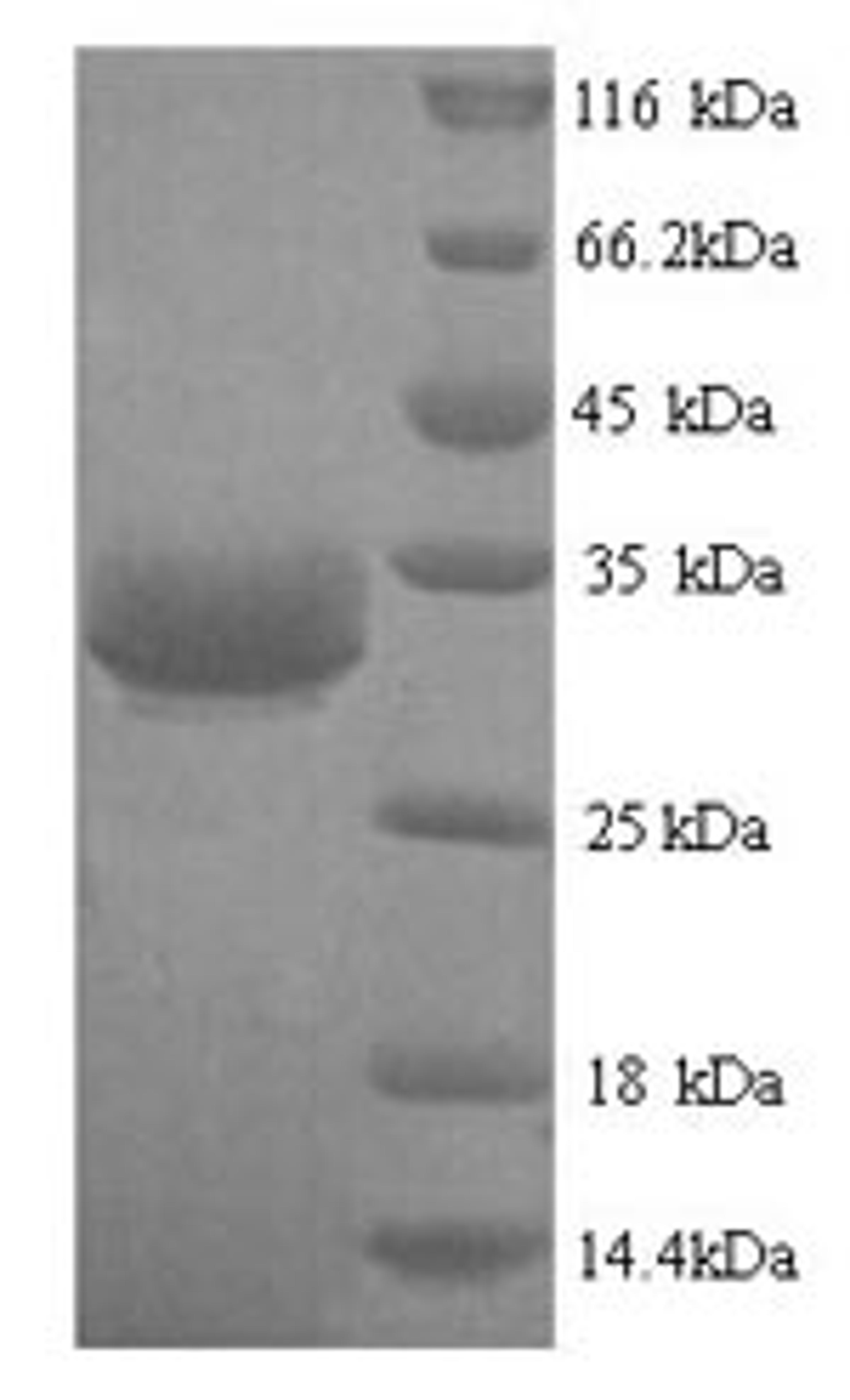 (Tris-Glycine gel) Discontinuous SDS-PAGE (reduced) with 5% enrichment gel and 15% separation gel.