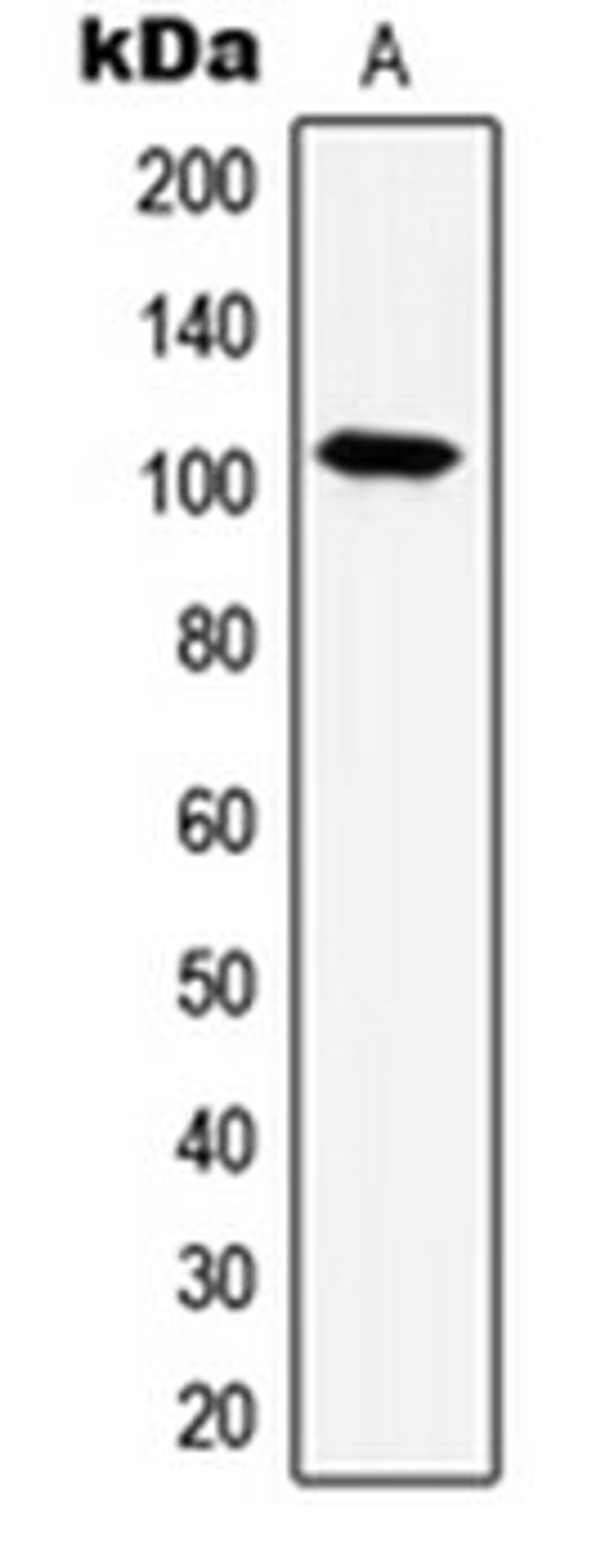 Western blot analysis of HeLa (Lane 1) whole cell lysates using HSPH1 antibody