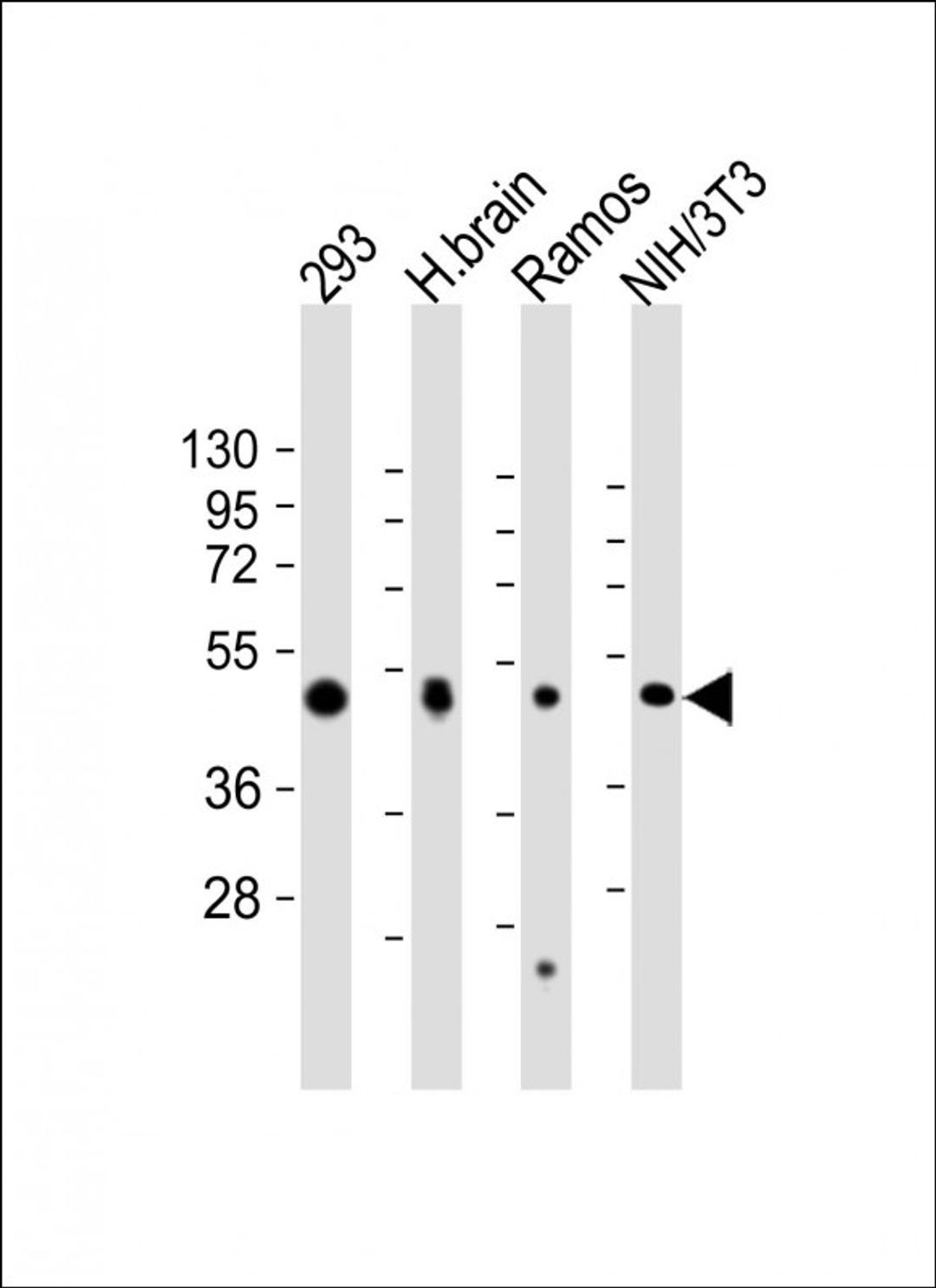 Western Blot at 1:2000 dilution Lane 1: 293 whole cell lysate Lane 2: human brain lysate Lane 3: Ramos whole cell lysate Lane 4: NIH/3T3 whole cell lysate Lysates/proteins at 20 ug per lane.