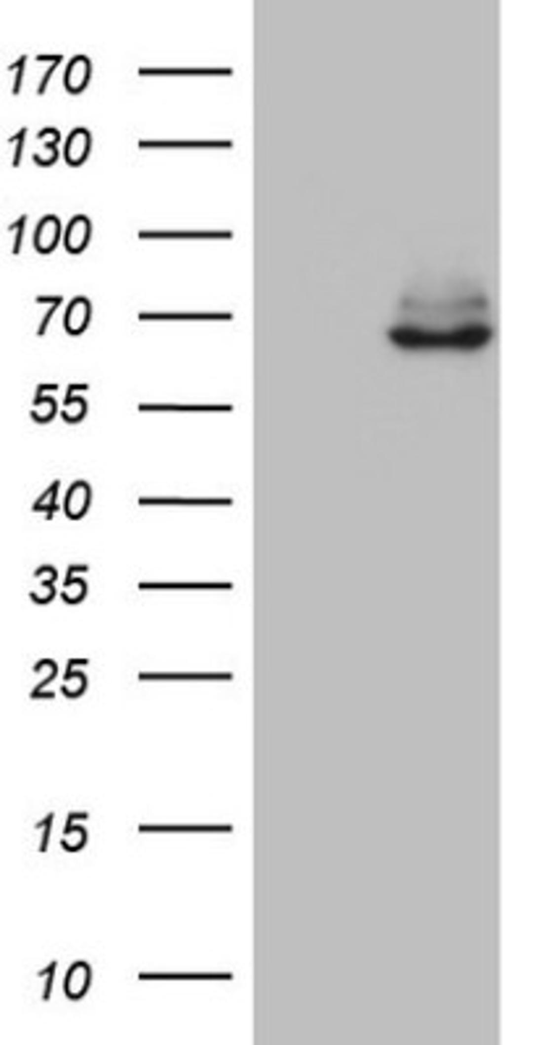 Western Blot: KLHL12/C3IP1 Antibody (4E1) [NBP2-45512] - Analysis of HEK293T cells were transfected with the pCMV6-ENTRY control (Left lane) or pCMV6-ENTRY KLHL12.