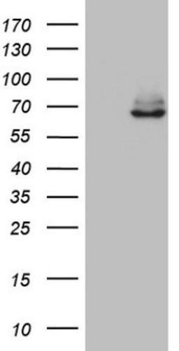 Western Blot: KLHL12/C3IP1 Antibody (4E1) [NBP2-45512] - Analysis of HEK293T cells were transfected with the pCMV6-ENTRY control (Left lane) or pCMV6-ENTRY KLHL12.