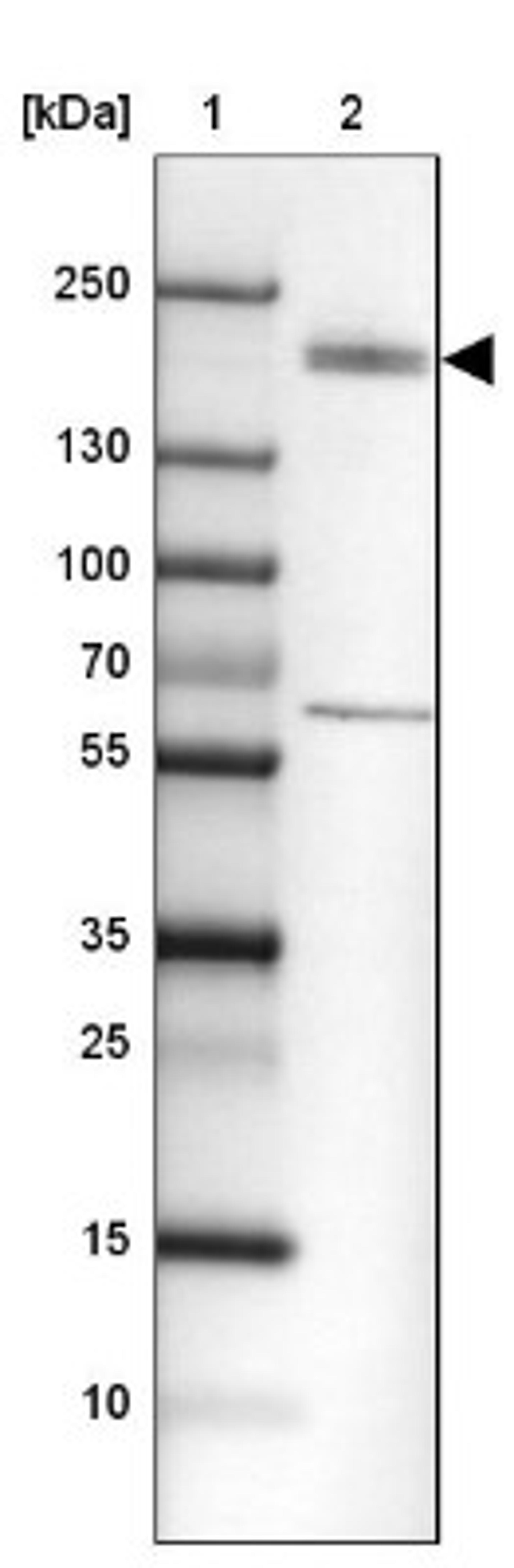 Western Blot: KIF13B Antibody [NBP1-83398] - Lane 1: Marker [kDa] 250, 130, 100, 70, 55, 35, 25, 15, 10<br/>Lane 2: Kidney