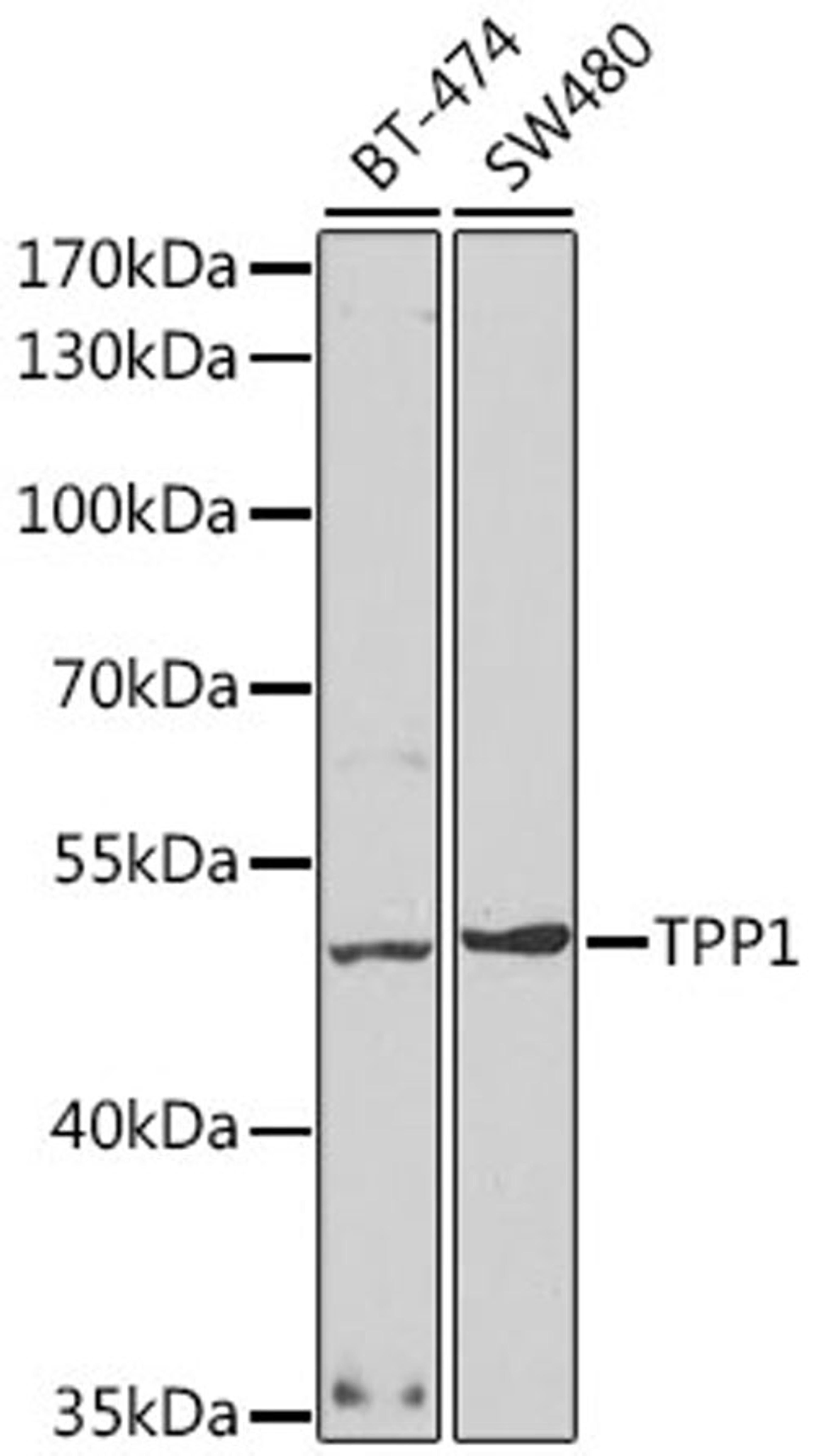 Western blot - TPP1 antibody (A5627)