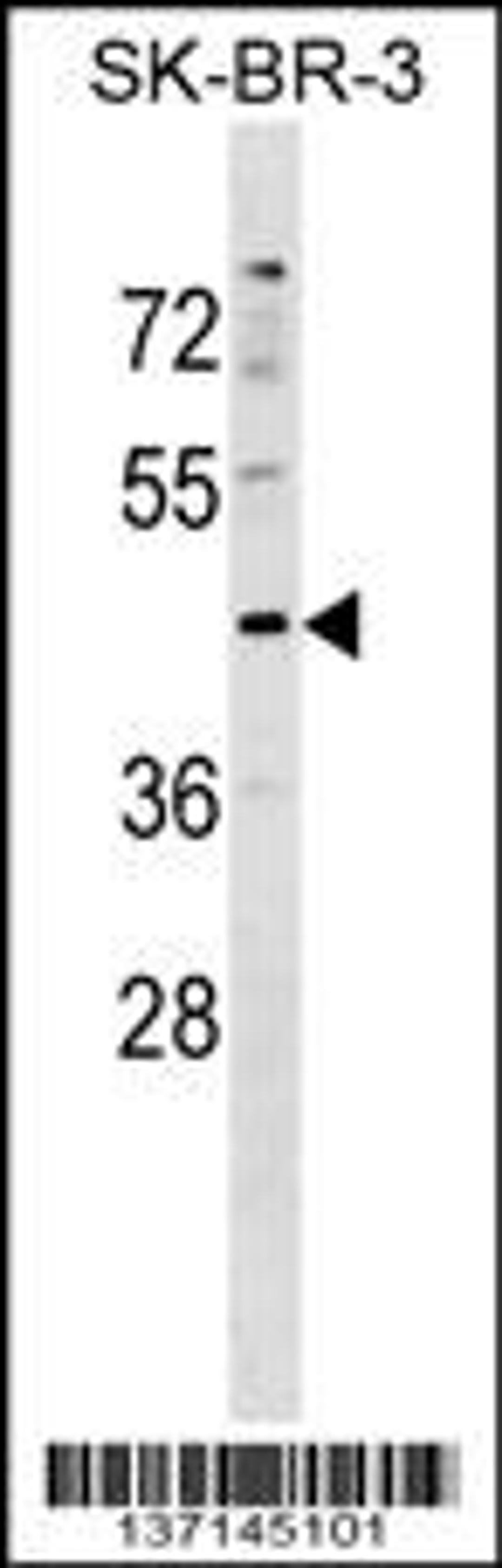 Western blot analysis in SK-BR-3 cell line lysates (35ug/lane).