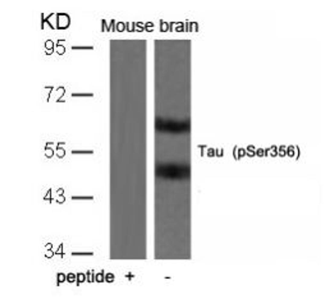 Western blot analysis of lysed extracts from mouse brain tissue using Tau (Phospho-Ser356).