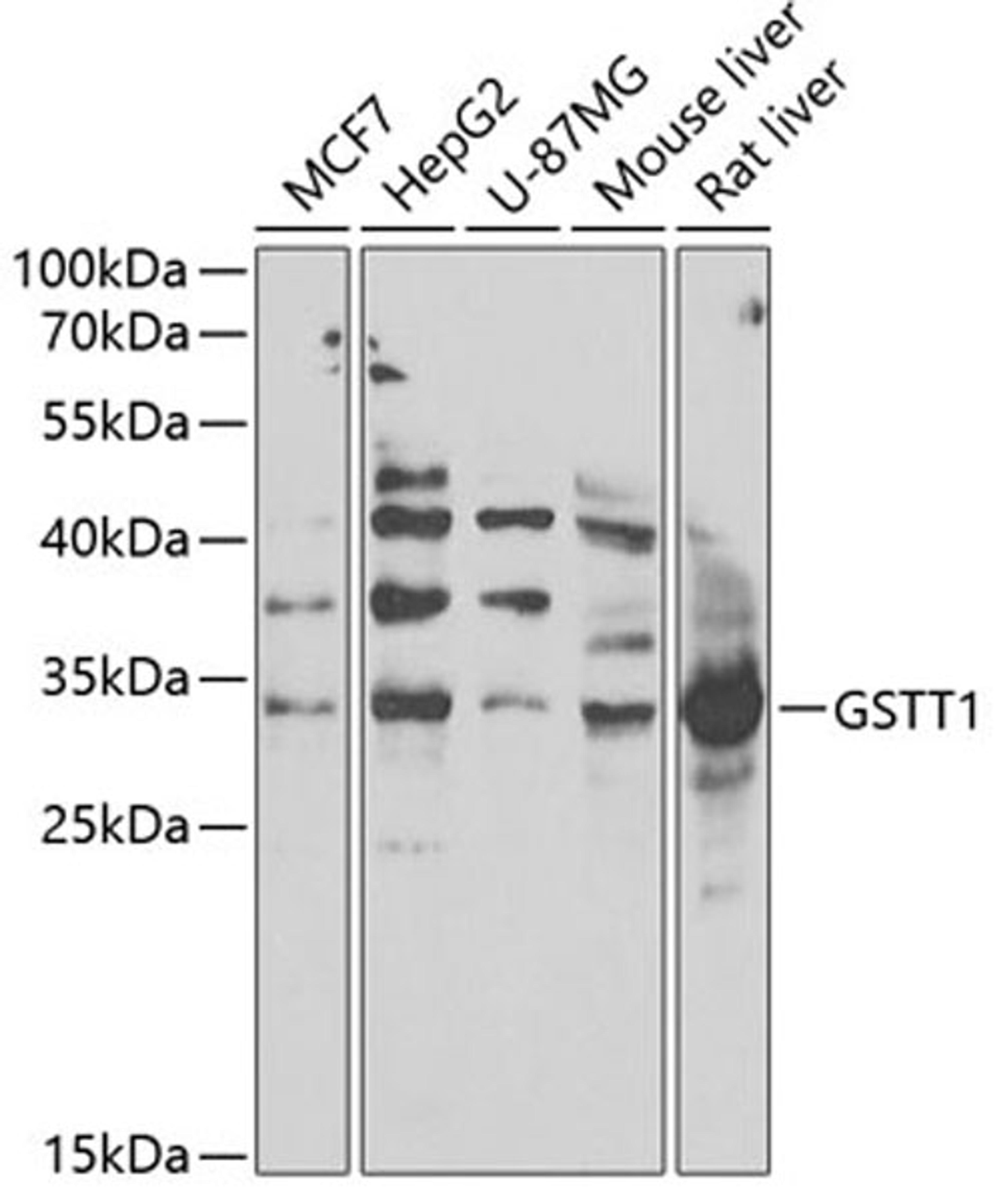 Western blot - GSTT1 antibody (A13996)