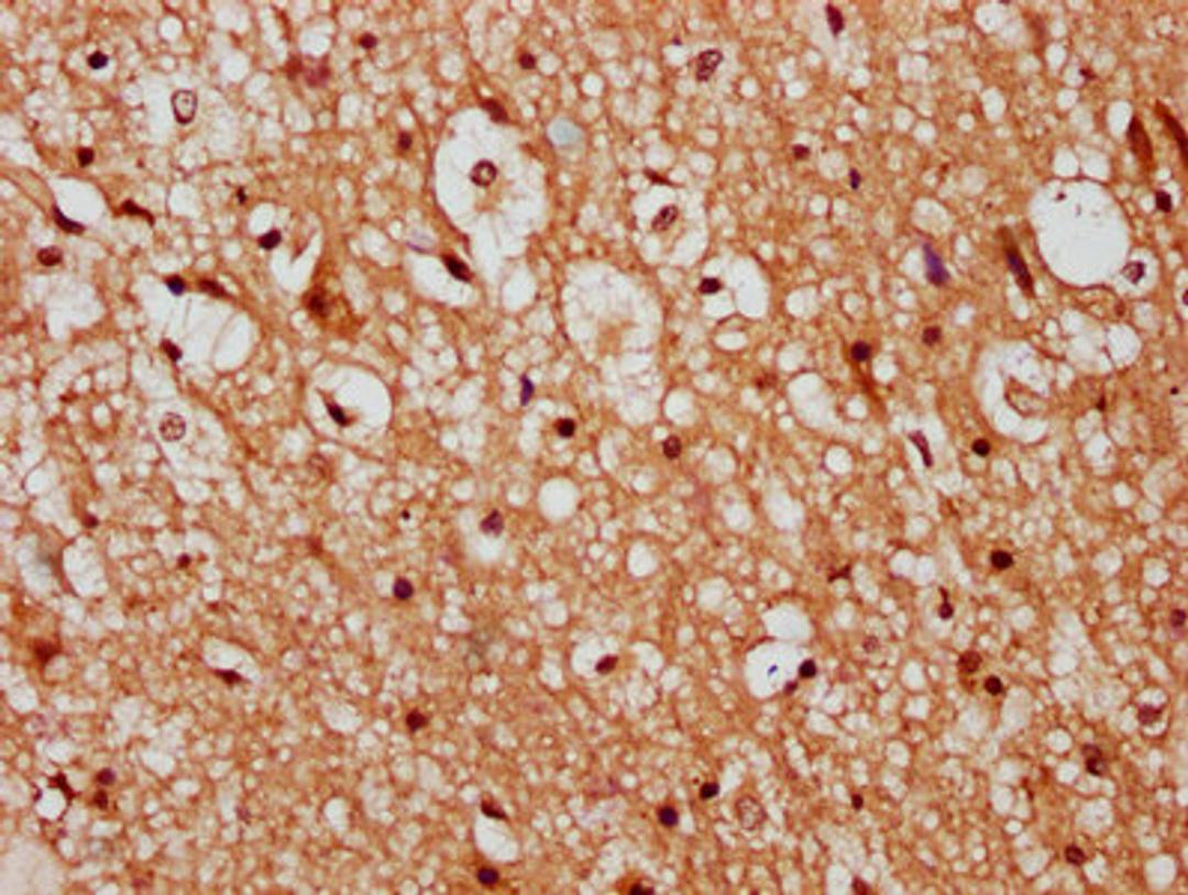 IHC image of CSB-PA23279A0Rb diluted at 1:300 and staining in paraffin-embedded human brain tissue performed on a Leica BondTM system. After dewaxing and hydration, antigen retrieval was mediated by high pressure in a citrate buffer (pH 6.0). Section was blocked with 10% normal goat serum 30min at RT. Then primary antibody (1% BSA) was incubated at 4&deg;C overnight. The primary is detected by a biotinylated secondary antibody and visualized using an HRP conjugated SP system.