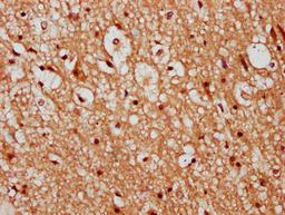 IHC image of CSB-PA23279A0Rb diluted at 1:300 and staining in paraffin-embedded human brain tissue performed on a Leica BondTM system. After dewaxing and hydration, antigen retrieval was mediated by high pressure in a citrate buffer (pH 6.0). Section was blocked with 10% normal goat serum 30min at RT. Then primary antibody (1% BSA) was incubated at 4&deg;C overnight. The primary is detected by a biotinylated secondary antibody and visualized using an HRP conjugated SP system.