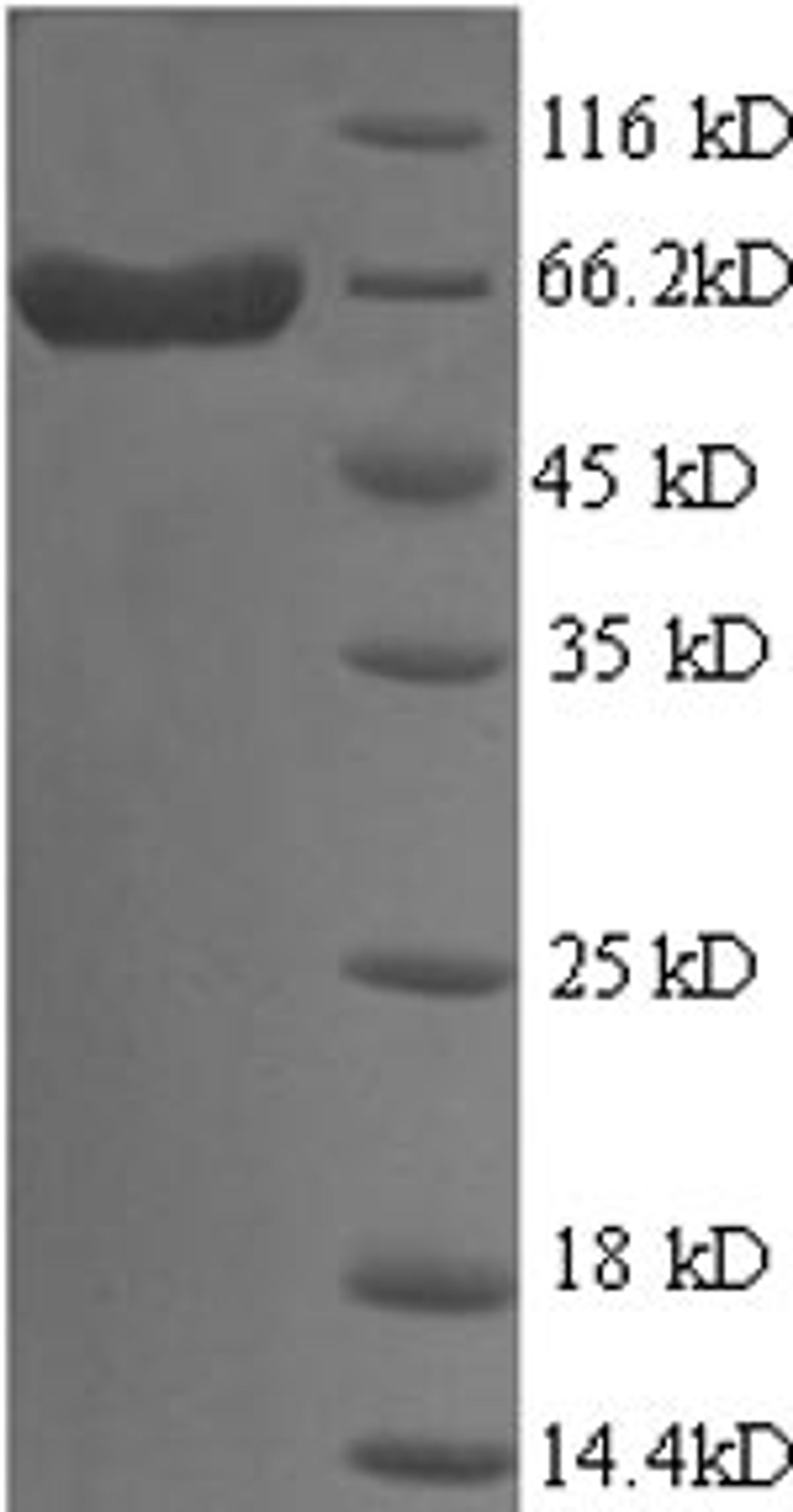 (Tris-Glycine gel) Discontinuous SDS-PAGE (reduced) with 5% enrichment gel and 15% separation gel.