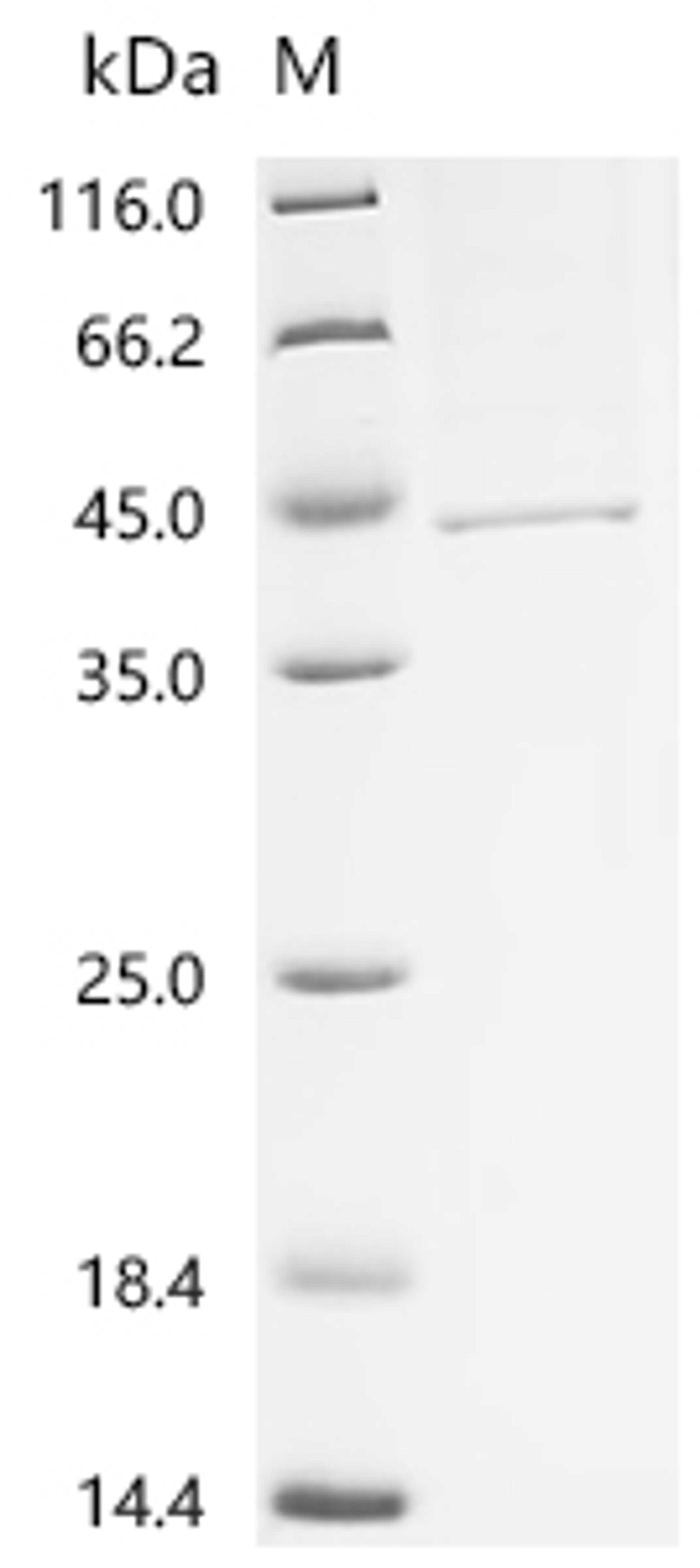 (Tris-Glycine gel) Discontinuous SDS-PAGE (reduced) with 5% enrichment gel and 15% separation gel.