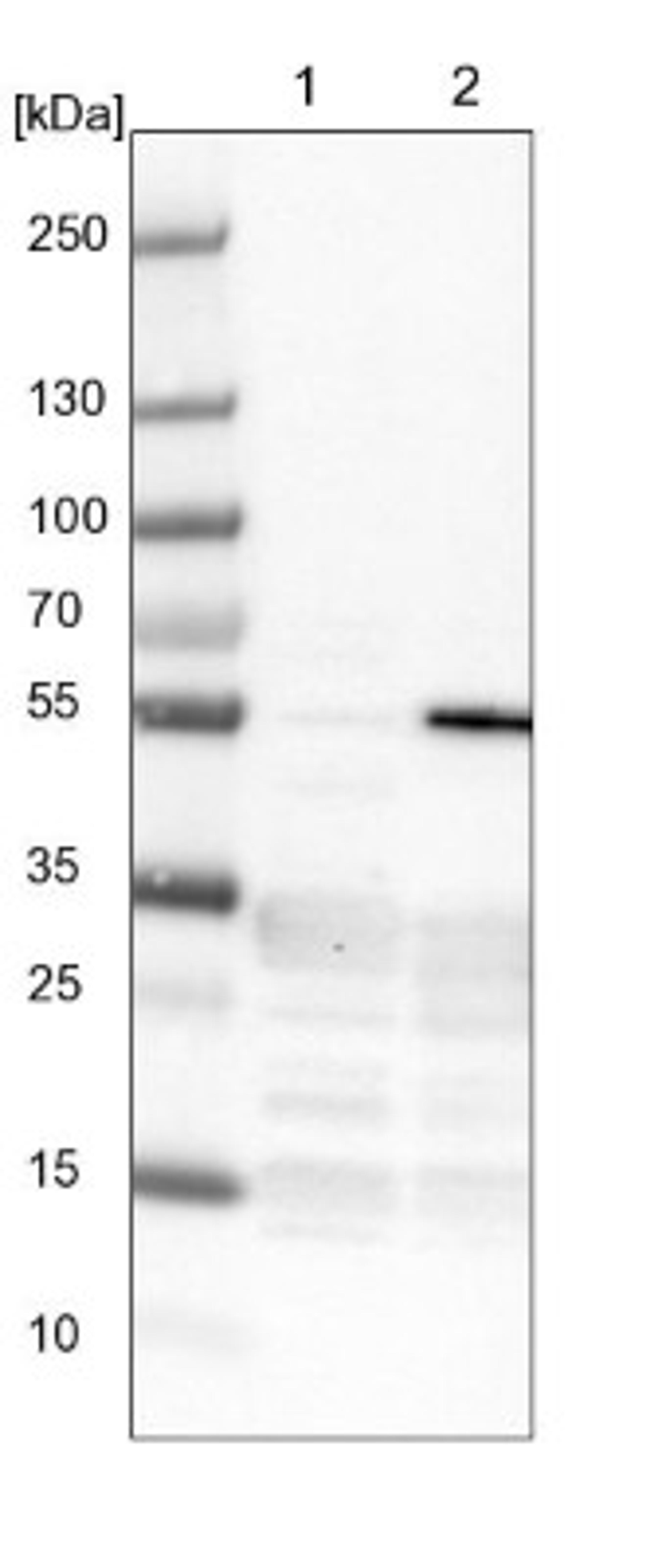 Western Blot: ZNF509 Antibody [NBP1-92628] - Lane 1: NIH-3T3 cell lysate (Mouse embryonic fibroblast cells)<br/>Lane 2: NBT-II cell lysate (Rat Wistar bladder tumour cells)