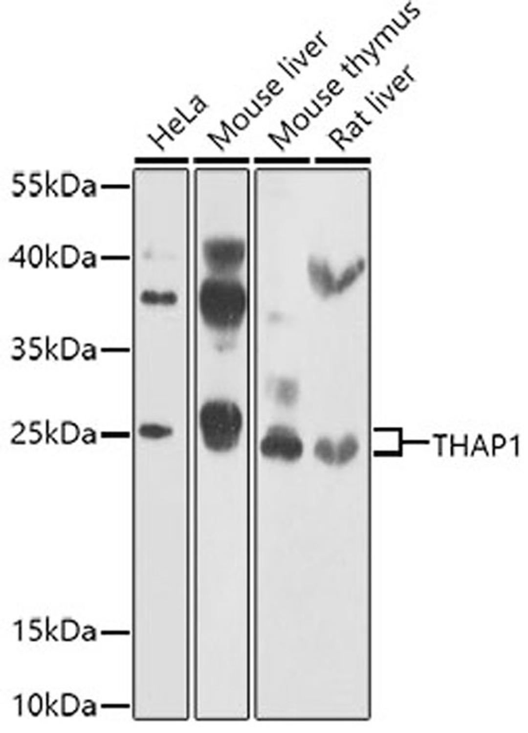 Western blot - THAP1 antibody (A7472)