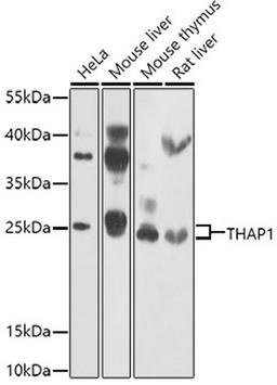 Western blot - THAP1 antibody (A7472)