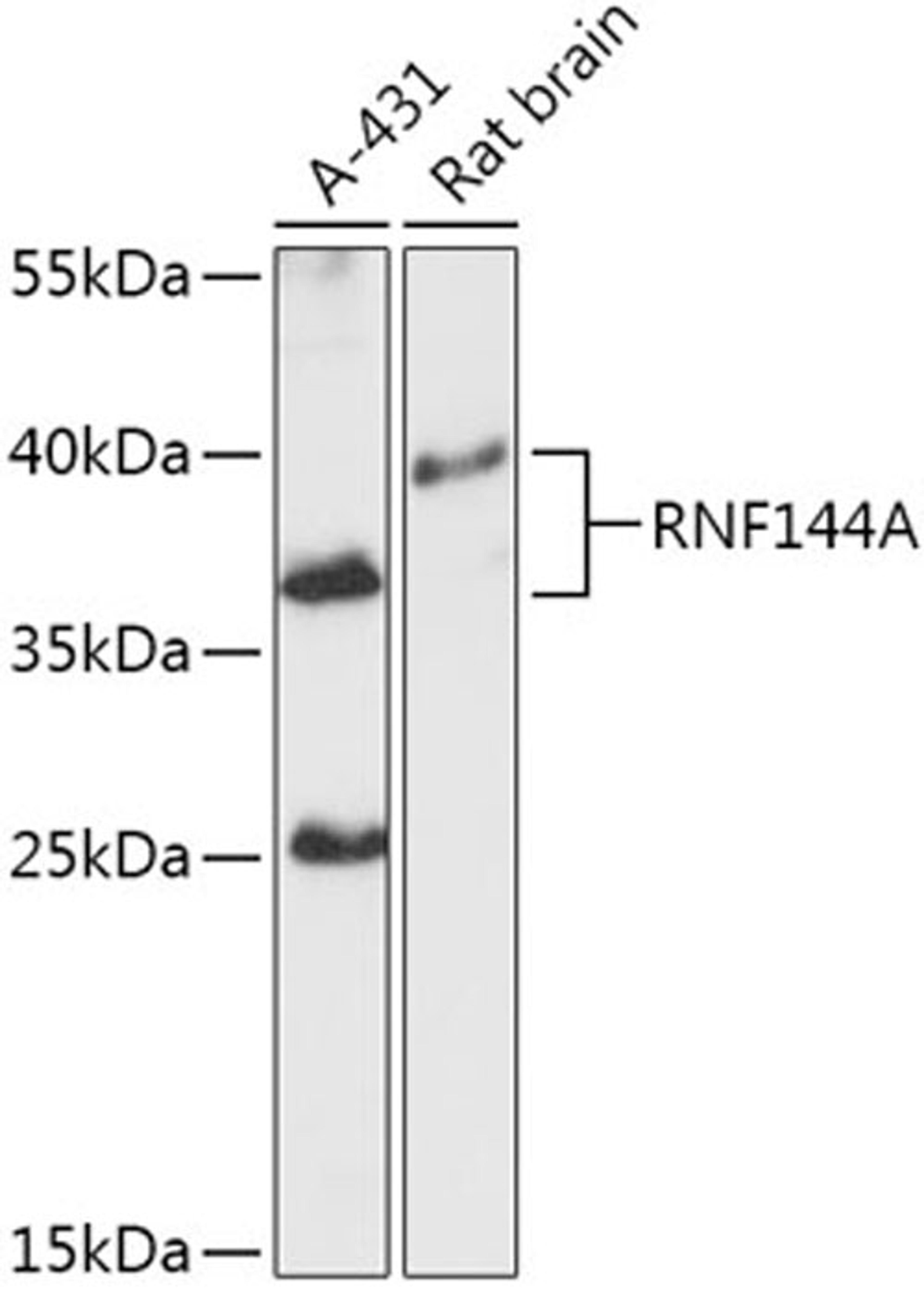 Western blot - RNF144A antibody (A17597)