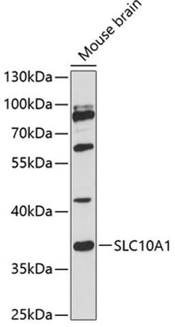 Western blot - SLC10A1 antibody (A12721)