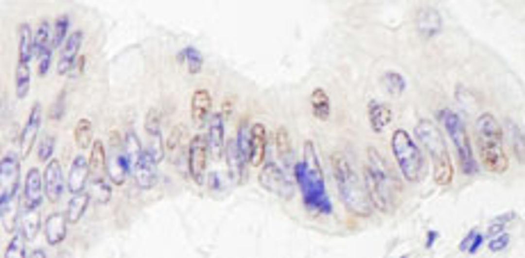 Detection of human JMJD2A by immunohistochemistry.