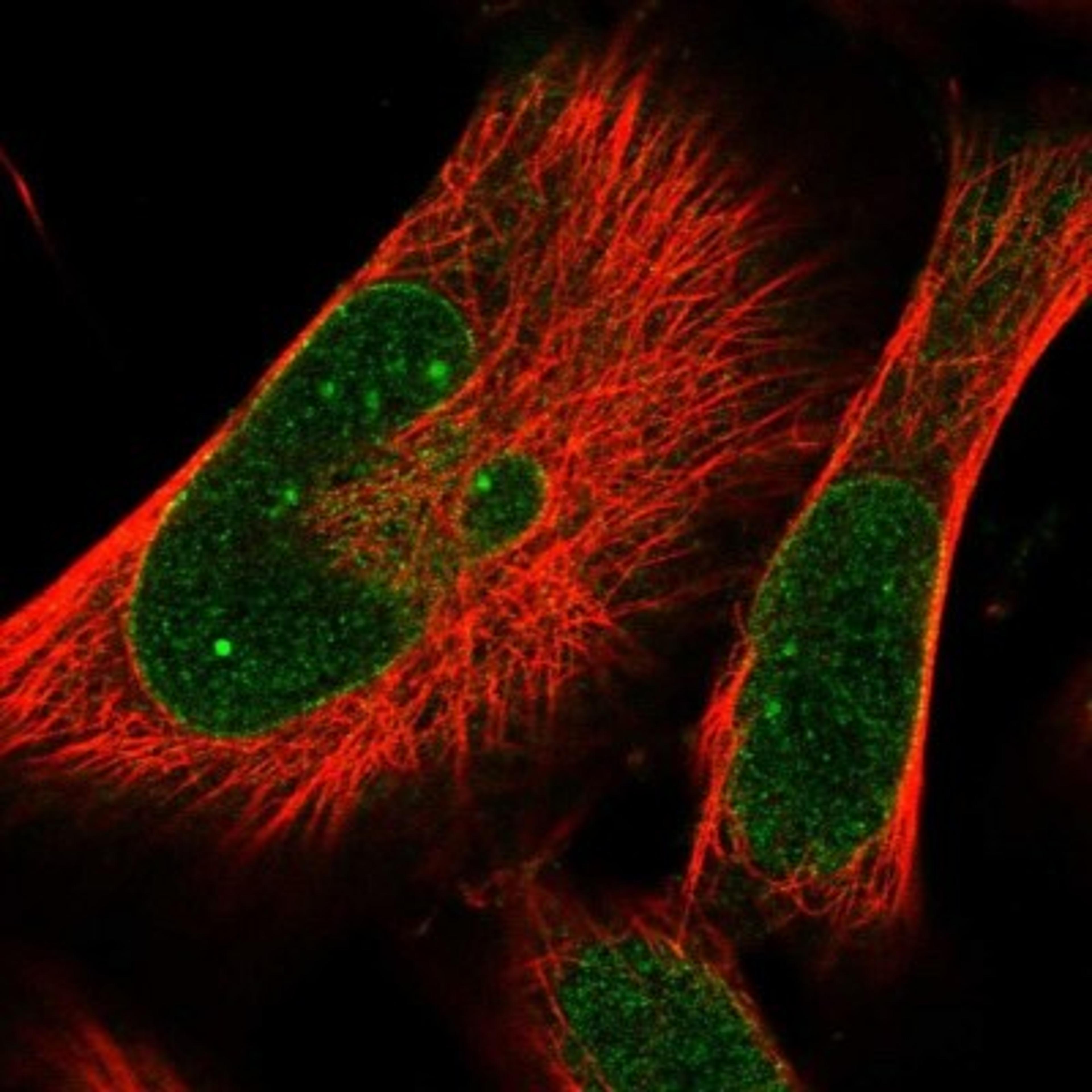 Immunocytochemistry/Immunofluorescence: PRA1 Antibody [NBP1-80883] - staining of human cell line U-251 MG shows positivity in nucleoli & nuclear membrane.