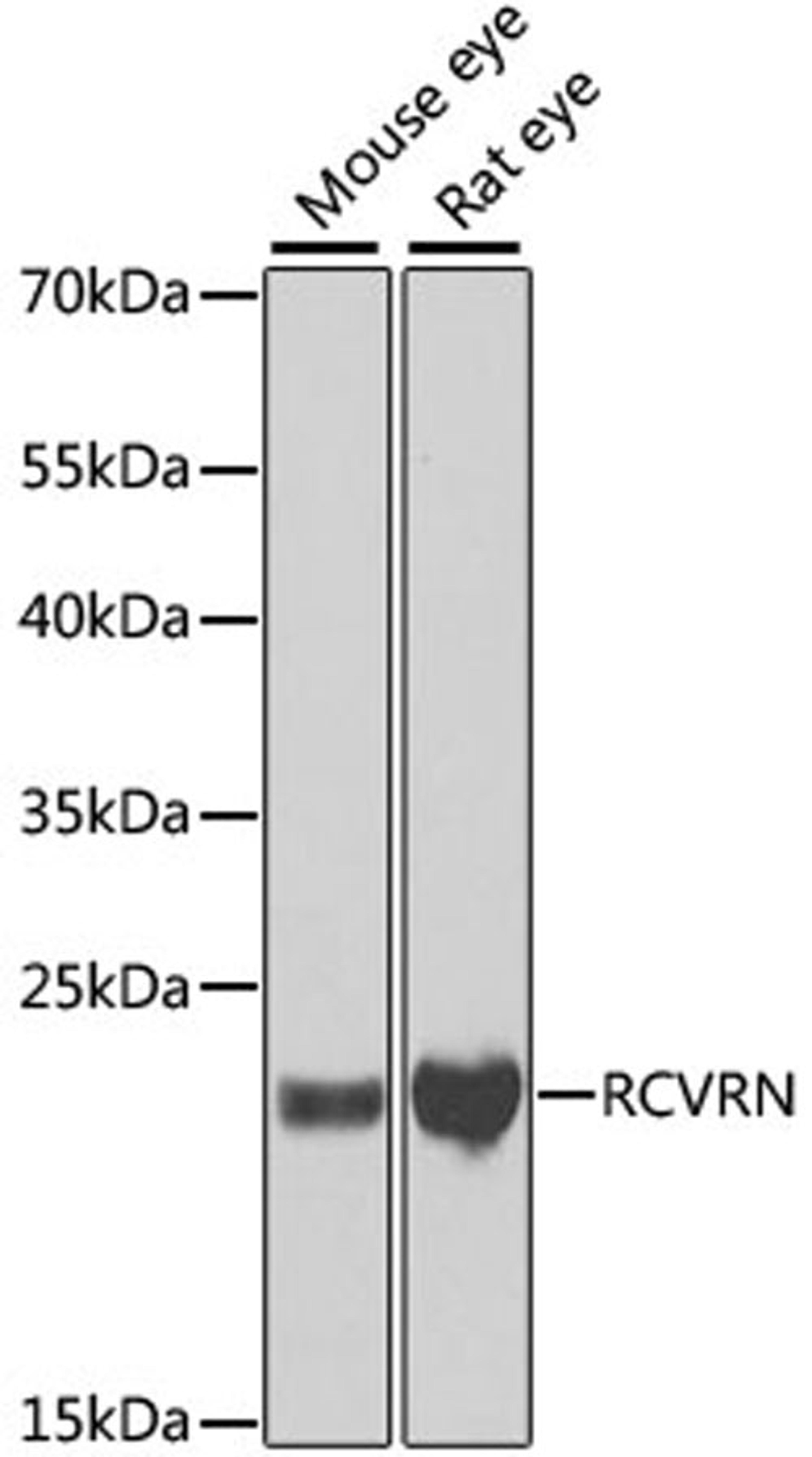 Western blot - RCVRN antibody (A6404)