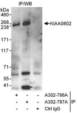 Detection of human KIAA0802 by western blot of immunoprecipitates.