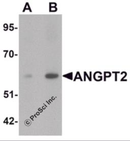 Western blot analysis of ANGPT2 in human liver tissue lysate with ANGPT2 antibody at (A) 1 and (B) 2 &#956;g/mL.