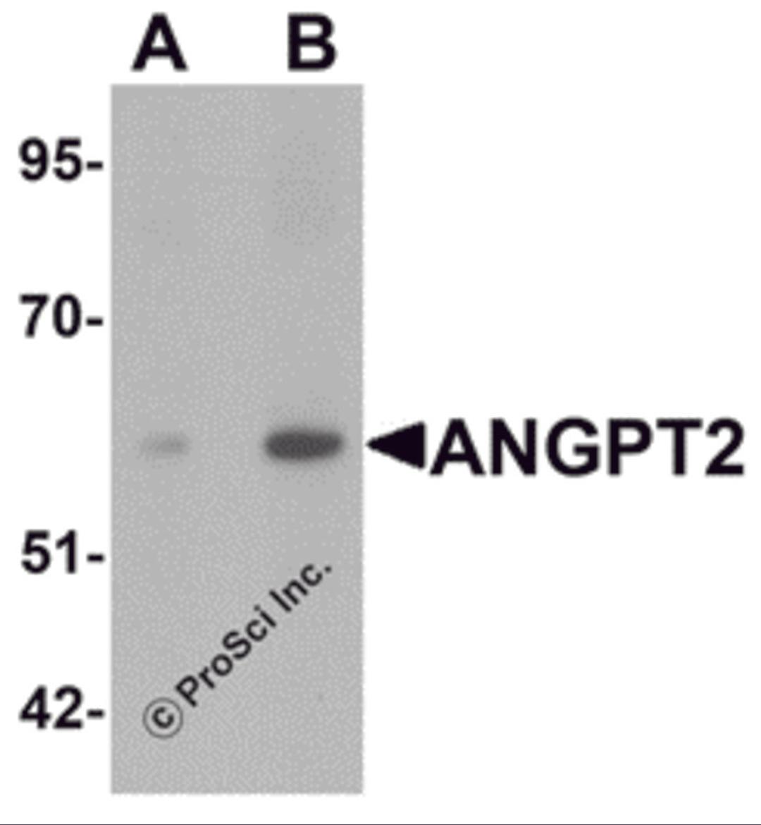 Western blot analysis of ANGPT2 in human liver tissue lysate with ANGPT2 antibody at (A) 1 and (B) 2 μg/mL.