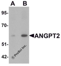 Western blot analysis of ANGPT2 in human liver tissue lysate with ANGPT2 antibody at (A) 1 and (B) 2 μg/mL.