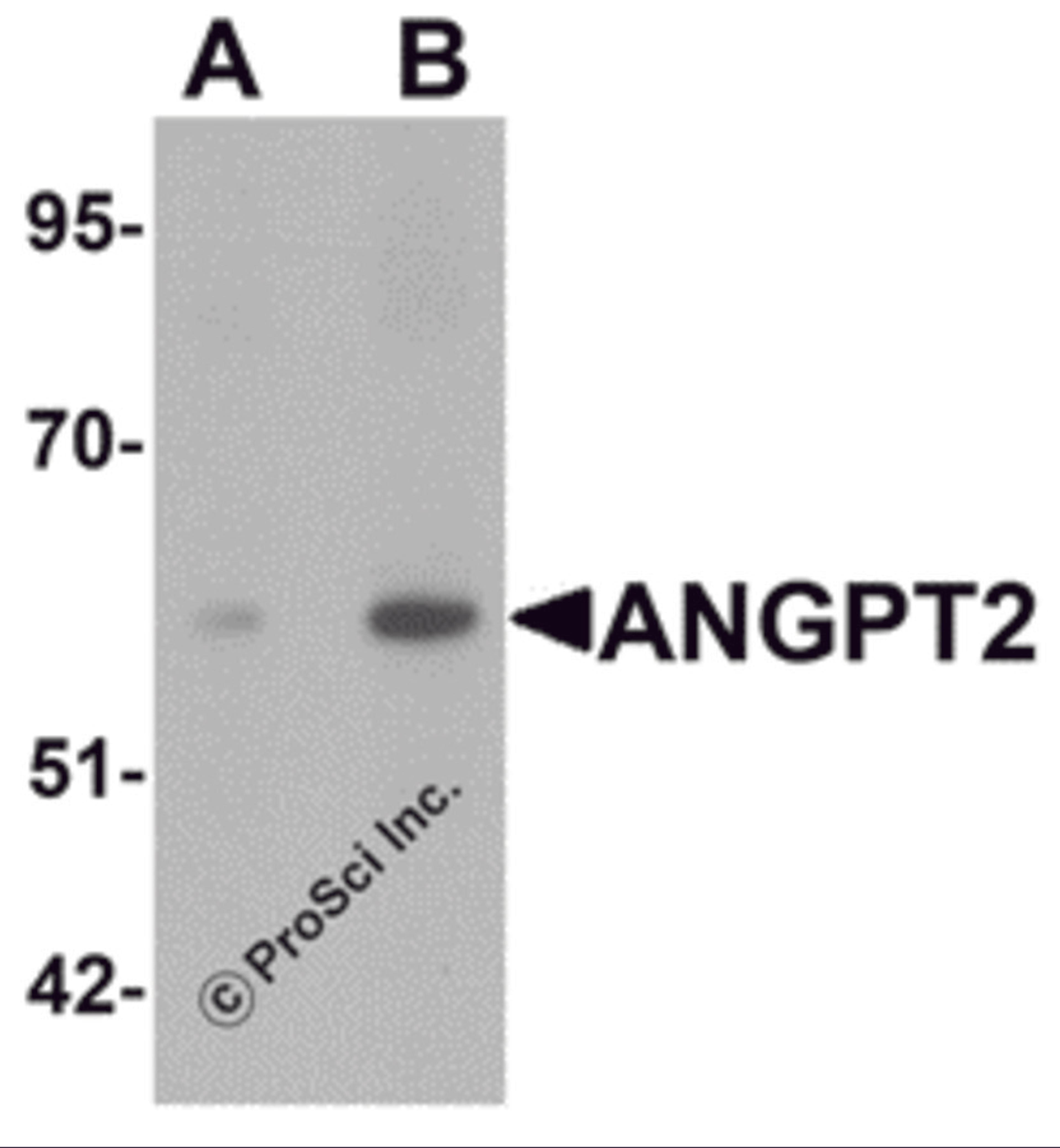Western blot analysis of ANGPT2 in human liver tissue lysate with ANGPT2 antibody at (A) 1 and (B) 2 μg/mL.