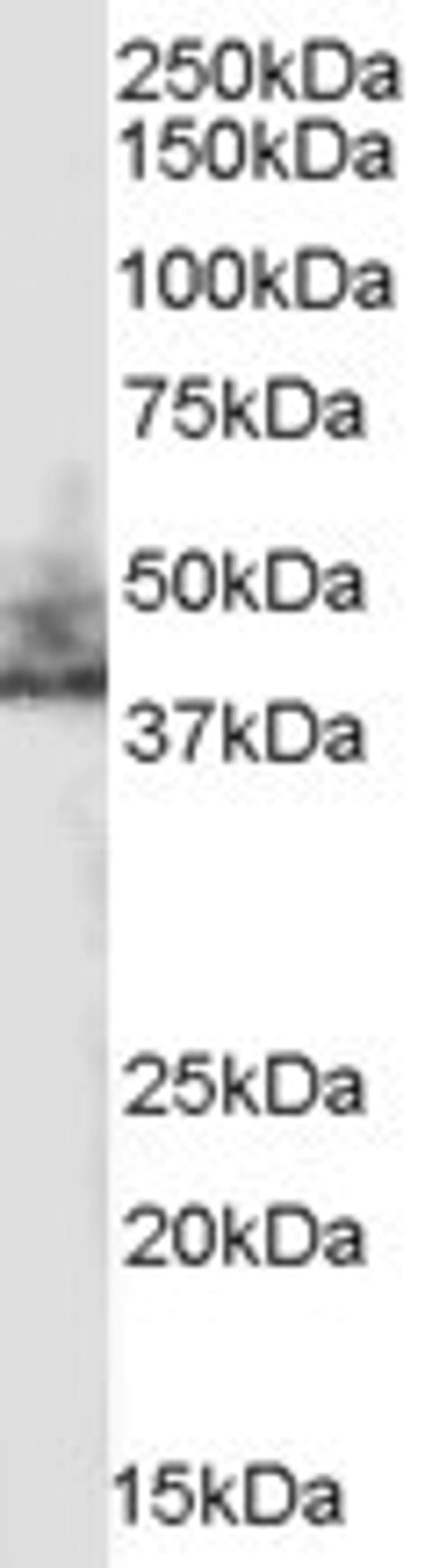 46-379 (0.3ug/ml) staining of human kidney lysate (35ug protein in RIPA buffer). Primary incubation was 1 hour. Detected by chemiluminescence.