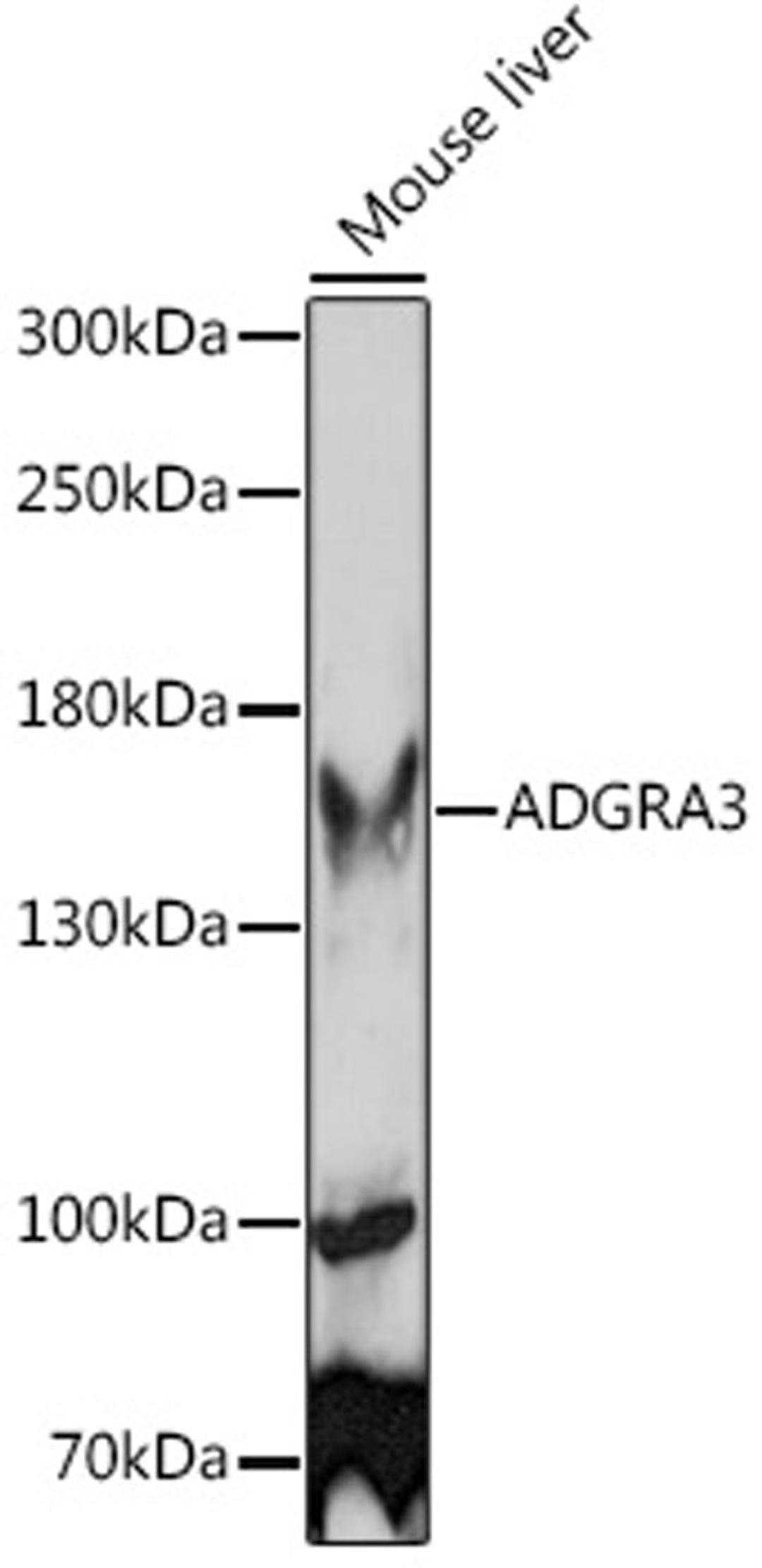 Western blot - ADGRA3 Rabbit pAb (A15573)