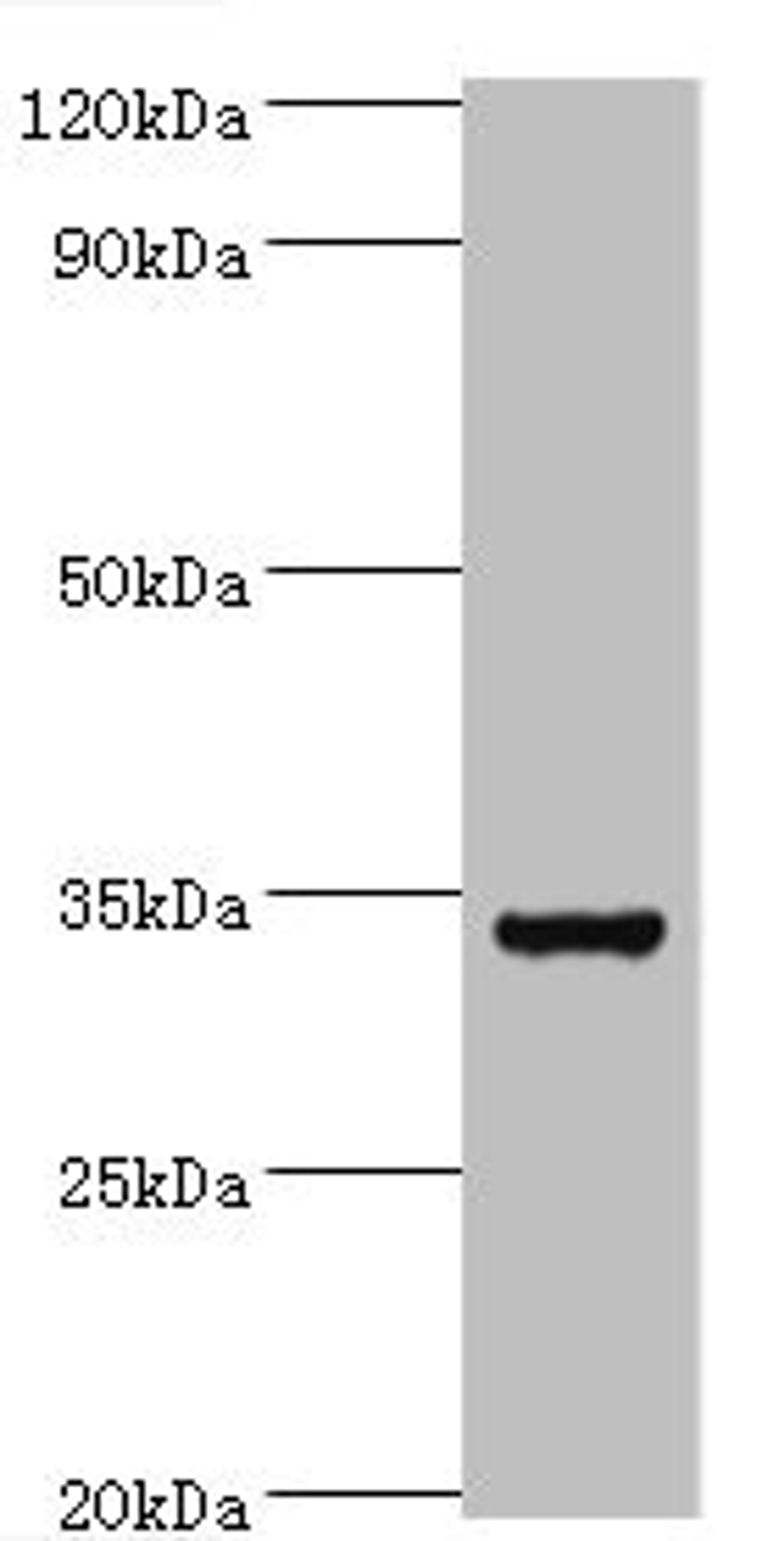 Western blot. All lanes: Baculoviral IAP repeat-containing protein 7 antibody at 6ug/ml + Hela whole cell lysate. Secondary. Goat polyclonal to rabbit IgG at 1/10000 dilution. Predicted band size: 33, 31 kDa. Observed band size: 33 kDa.