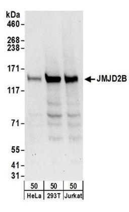 Detection of human JMJD2B by western blot.