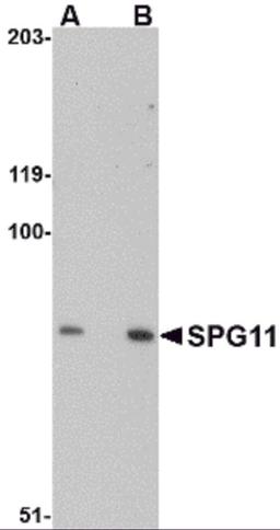 Western blot analysis of SPG11 in mouse heart tissue lysate with SPG11 antibody at (A) 0.5 and (B) 1 &#956;g/mL.